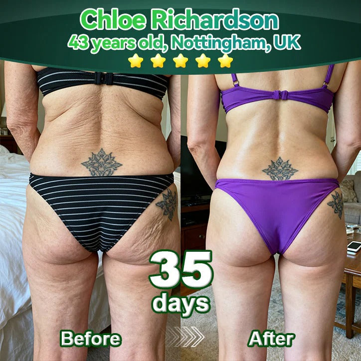 Officially Authorised Exclusive Edition✅|𝘠𝘦𝘴𝘵𝘳𝘦𝘦® 𝑆𝑡𝑒𝑚 𝐶𝑒𝑙𝑙 & 𝐶𝑜𝑙𝑙𝑎𝑔𝑒𝑛 𝑃𝑒𝑝𝑡𝑖𝑑𝑒 𝑂𝑟𝑎𝑙 𝐷𝑟𝑜𝑝𝑠 (Lift & Firm Sagging Skin & Reduce Wrinkle Formation)🍁