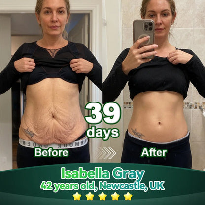 Officially Authorised Exclusive Edition✅|𝘠𝘦𝘴𝘵𝘳𝘦𝘦® 𝑆𝑡𝑒𝑚 𝐶𝑒𝑙𝑙 & 𝐶𝑜𝑙𝑙𝑎𝑔𝑒𝑛 𝑃𝑒𝑝𝑡𝑖𝑑𝑒 𝑂𝑟𝑎𝑙 𝐷𝑟𝑜𝑝𝑠 (Lift & Firm Sagging Skin & Reduce Wrinkle Formation)🍁