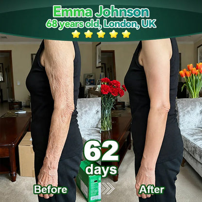 Officially Authorised Exclusive Edition✅|𝘠𝘦𝘴𝘵𝘳𝘦𝘦® 𝑆𝑡𝑒𝑚 𝐶𝑒𝑙𝑙 & 𝐶𝑜𝑙𝑙𝑎𝑔𝑒𝑛 𝑃𝑒𝑝𝑡𝑖𝑑𝑒 𝑂𝑟𝑎𝑙 𝐷𝑟𝑜𝑝𝑠 (Lift & Firm Sagging Skin & Reduce Wrinkle Formation)🍁