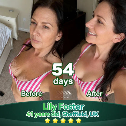 Officially Authorised Exclusive Edition✅|𝘠𝘦𝘴𝘵𝘳𝘦𝘦® 𝑆𝑡𝑒𝑚 𝐶𝑒𝑙𝑙 & 𝐶𝑜𝑙𝑙𝑎𝑔𝑒𝑛 𝑃𝑒𝑝𝑡𝑖𝑑𝑒 𝑂𝑟𝑎𝑙 𝐷𝑟𝑜𝑝𝑠 (Lift & Firm Sagging Skin & Reduce Wrinkle Formation)🍁